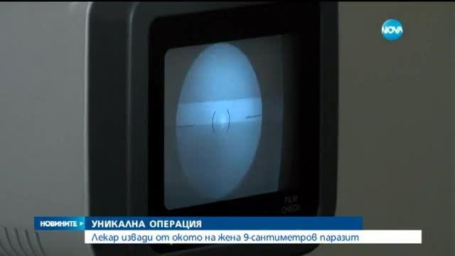 Уникална операция в България 2015 ! Лекар извади 9-сантиметров паразит от окото на жена